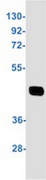 ACADM Recombinant Rabbit Monoclonal Antibody