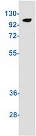 Phospho-TAOK1/TAOK2/TAOK3 (Ser181, Ser181, Ser177) Recombinant Rabbit Monoclonal Antibody