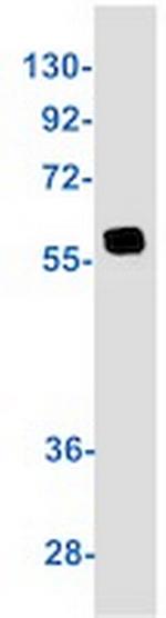 Phospho-SRC (Tyr530) Antibody in Western Blot (WB)