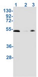 Phospho-SMAD1 (Ser463, Ser465) Recombinant Rabbit Monoclonal Antibody