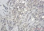 Phospho-PRKCG (Thr410, Thr412) Recombinant Rabbit Monoclonal Antibody