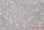 Phospho-PRKCA (Ser660) Recombinant Rabbit Monoclonal Antibody