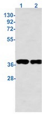 Phospho-NPM1 (Thr199) Antibody in Western Blot (WB)