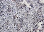 Phospho-EGFR (Tyr1173) Antibody in Immunohistochemistry (Paraffin) (IHC (P))