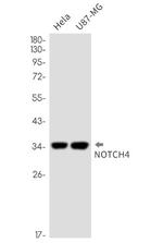 NOTCH4 Recombinant Rabbit Monoclonal Antibody