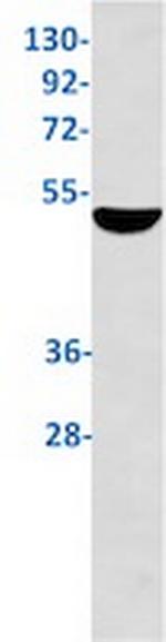 KRT17 Antibody in Western Blot (WB)