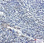 FGFR3 Antibody in Immunohistochemistry (Paraffin) (IHC (P))
