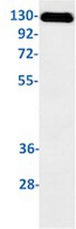 FGFR3 Antibody in Western Blot (WB)