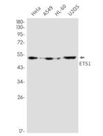 ETS1 Recombinant Rabbit Monoclonal Antibody