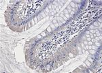 PAK1 Antibody in Immunohistochemistry (Paraffin) (IHC (P))