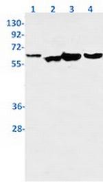 PAK1 Antibody in Western Blot (WB)