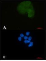 MAP2K1 Recombinant Rabbit Monoclonal Antibody