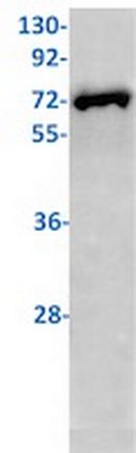 ZAP70 Recombinant Rabbit Monoclonal Antibody
