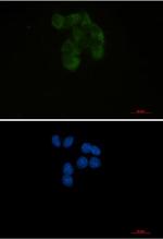 YBX1 Antibody in Immunocytochemistry (ICC/IF)