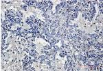 YBX1 Antibody in Immunohistochemistry (Paraffin) (IHC (P))
