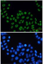 ERCC2 Recombinant Rabbit Monoclonal Antibody