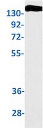 XDH Recombinant Rabbit Monoclonal Antibody