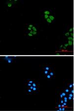 WNT5A Recombinant Rabbit Monoclonal Antibody
