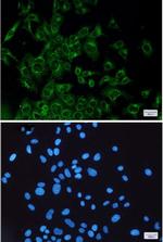 VEGFD Recombinant Rabbit Monoclonal Antibody