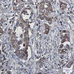 VEGFD Antibody in Immunohistochemistry (Paraffin) (IHC (P))
