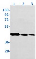 VEGFD Antibody in Western Blot (WB)