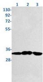 VDAC1 Antibody in Western Blot (WB)