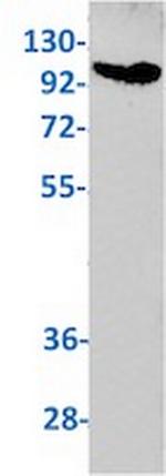 USP7 Recombinant Rabbit Monoclonal Antibody
