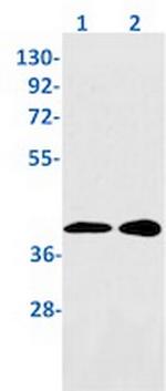 UCHL5 Recombinant Rabbit Monoclonal Antibody