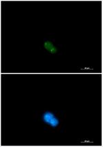 UBA2 Recombinant Rabbit Monoclonal Antibody