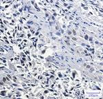 NKX2-1 Recombinant Rabbit Monoclonal Antibody