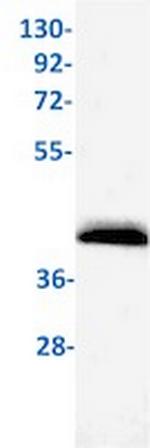 NKX2-1 Antibody in Western Blot (WB)