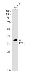 NKX2-1 Antibody in Western Blot (WB)