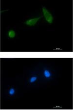 TSG101 Recombinant Rabbit Monoclonal Antibody