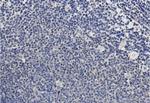 TSG101 Antibody in Immunohistochemistry (Paraffin) (IHC (P))