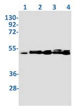 TSG101 Antibody in Western Blot (WB)