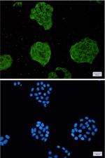 TRIM56 Recombinant Rabbit Monoclonal Antibody