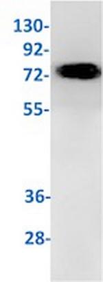 TGM2 Antibody in Western Blot (WB)
