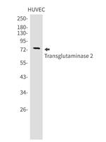 TGM2 Antibody in Western Blot (WB)