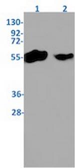 TMEM161B Recombinant Rabbit Monoclonal Antibody