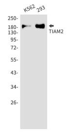 TIAM2 Recombinant Rabbit Monoclonal Antibody
