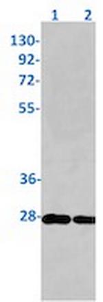 TK1 Recombinant Rabbit Monoclonal Antibody