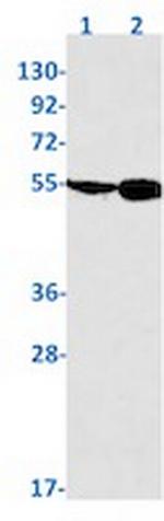 TEAD4 Recombinant Rabbit Monoclonal Antibody