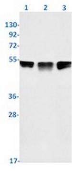 TEAD1 Recombinant Rabbit Monoclonal Antibody