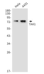 MAP3K7 Recombinant Rabbit Monoclonal Antibody
