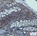 SNTA1 Antibody in Immunohistochemistry (Paraffin) (IHC (P))