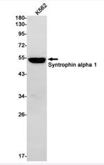 SNTA1 Antibody in Western Blot (WB)