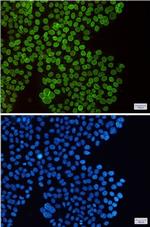 SUN1 Recombinant Rabbit Monoclonal Antibody