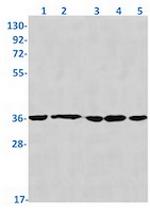 STUB1 Antibody in Western Blot (WB)