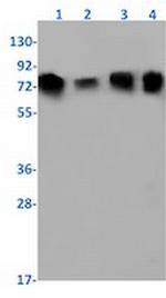 STIM1 Recombinant Rabbit Monoclonal Antibody