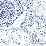 STK3 Recombinant Rabbit Monoclonal Antibody